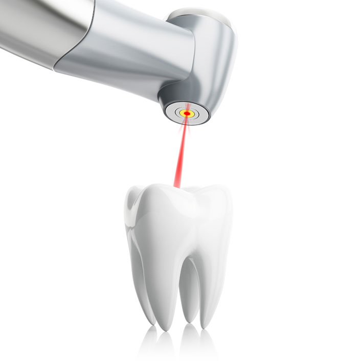 Laser Dentistry - Dental Services